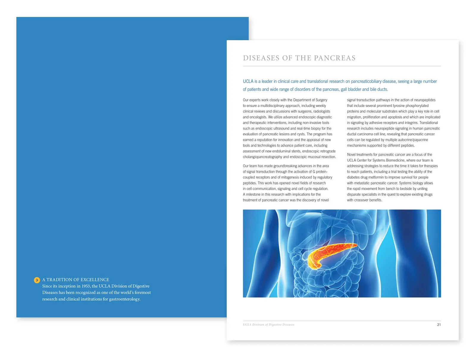 Diseases of the Pancreas brochure spread with a medical illustration